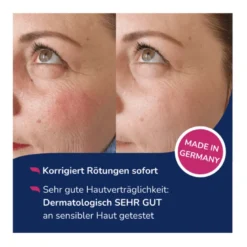 Allergika Anti-Rötung Getöntes Tagesfluid LSF 50+, 30 ml