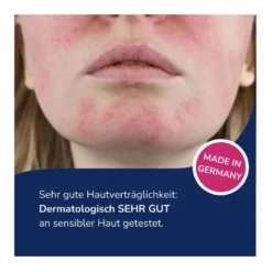 Allergika Anti-Rötung Milder Reinigungsschaum, 150 ml