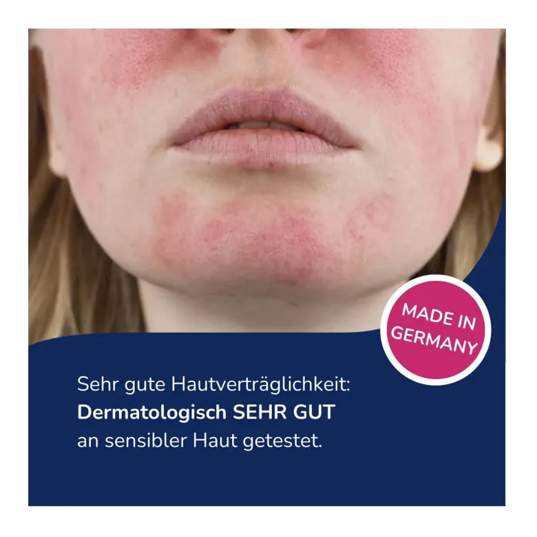 Allergika Anti-Rötung Milder Reinigungsschaum, 150 ml