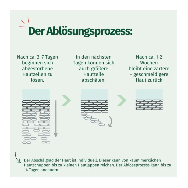 Allgäuer Latschenkiefer Hornhaut Entferner Maske Cremig, 1 P
