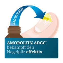 Amorolfin Adgc 50 mg/ml wirkstoffhaltiger Nagellack, 3 ml