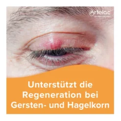 Artelac Augenlidhelfer, 15 g