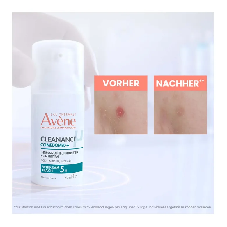 Avene Cleanance Comedomed Anti-Unreinheiten Konzentrat, 30 ml