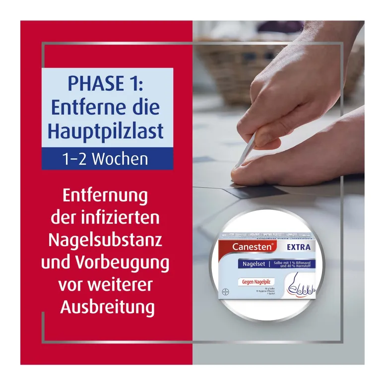 Canesten Extra Nagelset, 1 St