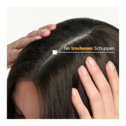 Ducray Kelual Squanorm Shampoo Trockene Schuppen, 200 ml