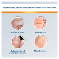 EndWarts Classic Lösung, 3 ml
