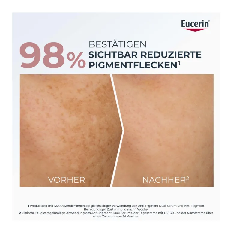 Eucerin Anti-Pigment Dual Serum, 30 ml