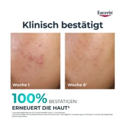Eucerin DermoPure Clinical Peeling 10 Nachtpflege, 40 ml