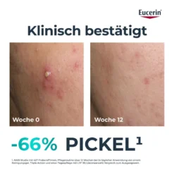 Eucerin DermoPure Clinical Triple Action Pflege, 40 ml