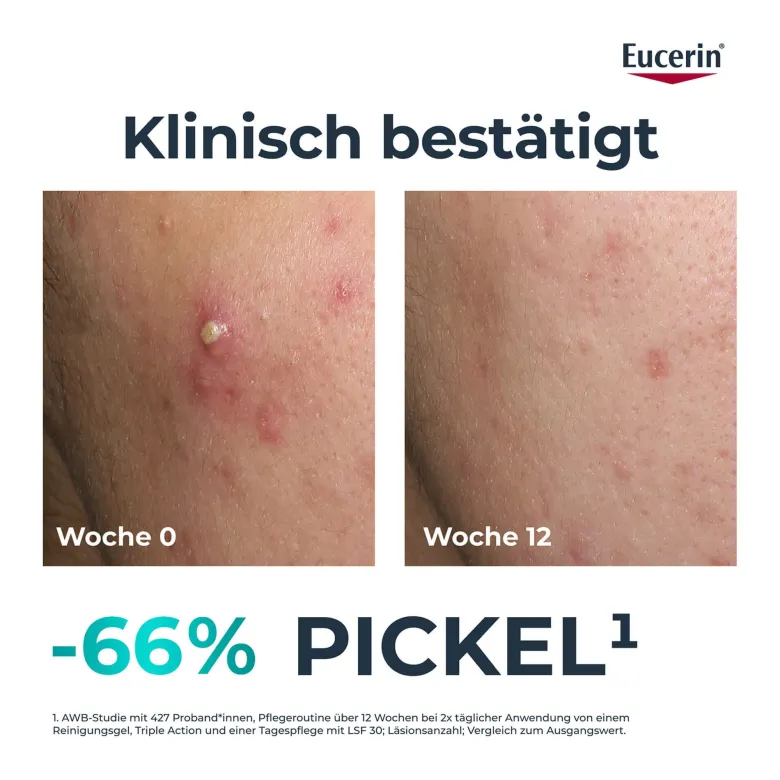 Eucerin DermoPure Clinical Triple Action Pflege, 40 ml
