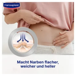 Hansaplast Pflaster zur Behandlung von großen Narben XL, 21 St