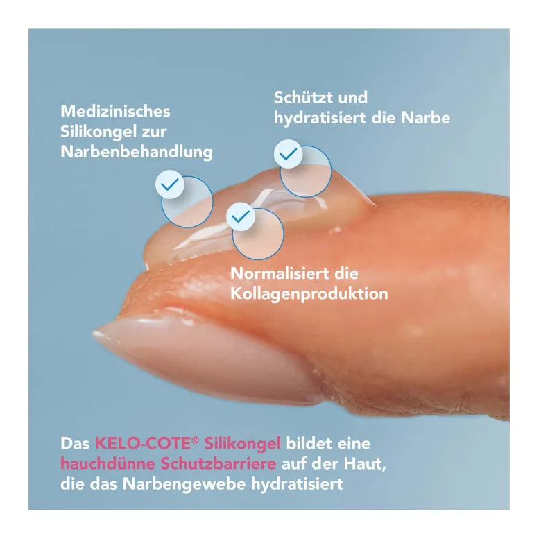Kelo-Cote Kids Silikon-Narbengel, 6 g