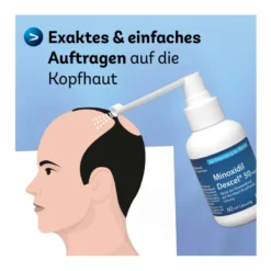Minoxidil Dexcel 50 mg/ml Spray, 60 ml