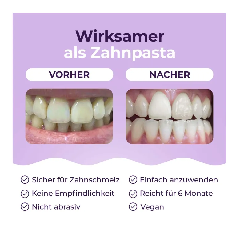 OnlySmile Zahnaufhellungspulver, 75 g