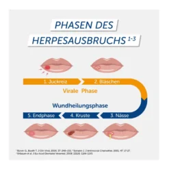Pencivir bei Lippenherpes Creme hautfarben 1%, 2 g
