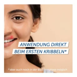 Pencivir Creme bei Lippenherpes, 2 g