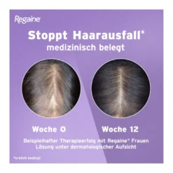 Regaine Frauen Lösung, 3X60 ml
