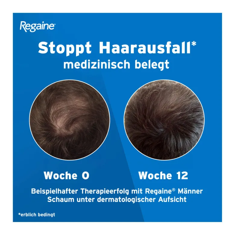 Regaine Männer Schaum, 3X60 ml