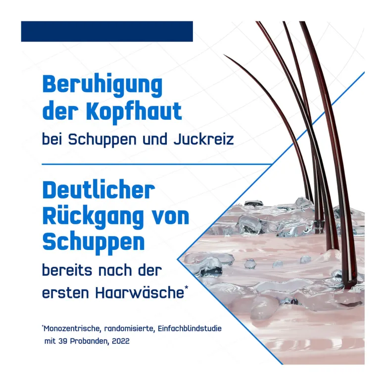 Terzolin Expert Shampoo bei fettiger Kopfhaut, 200 ml