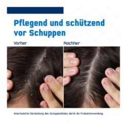 Terzolin Expert Shampoo bei fettiger Kopfhaut, 200 ml