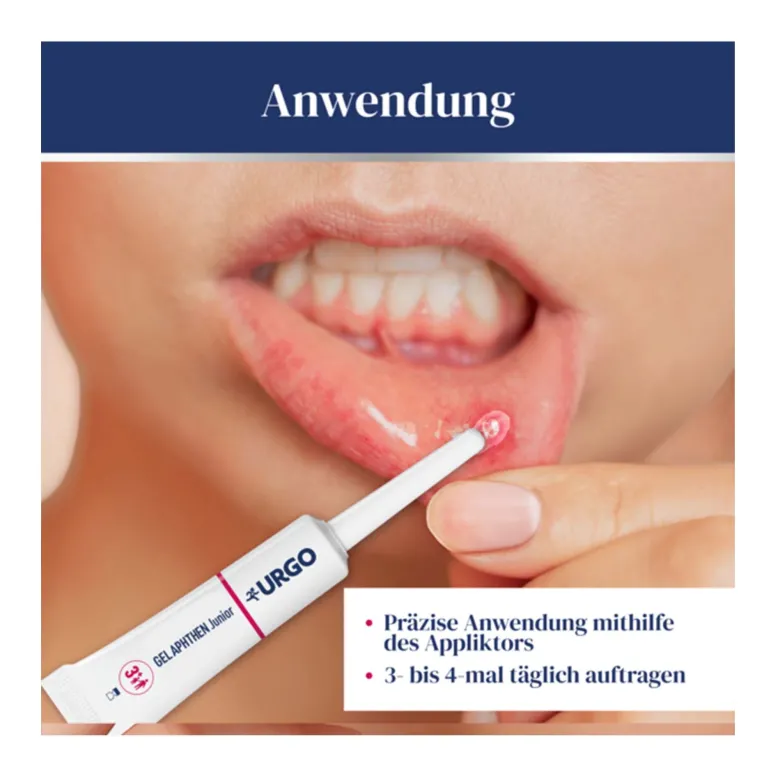 Urgo Aphthen Gel Junior, 8 ml