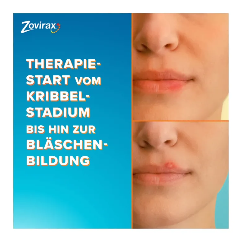 Zovirax Lippenherpescreme, 2 g